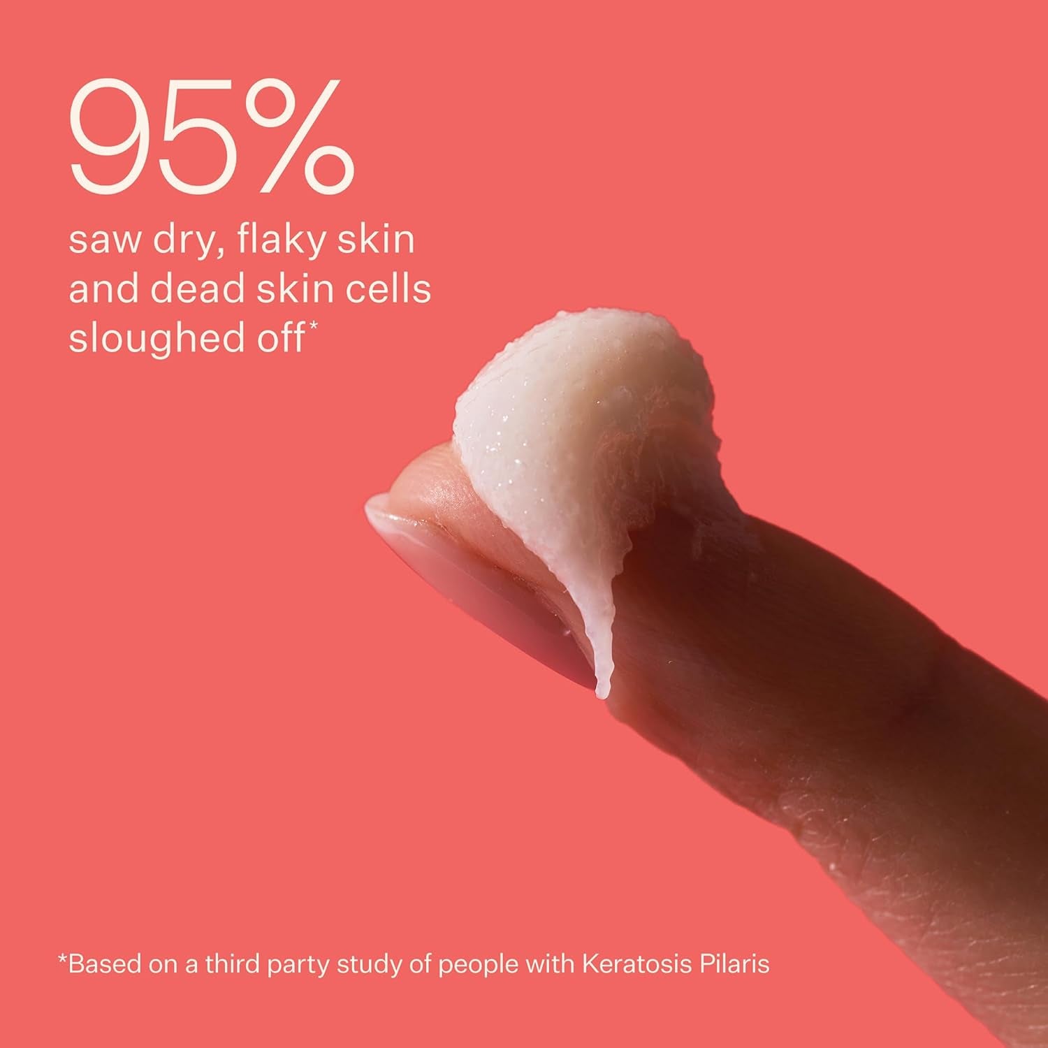 KP Bump Boss Microderm Body Scrub | 10% AHA (7% Glycolic Acid + 3% Lactic Acid) | Smooth, Silky-Soft and Radiant Skin | Clean, Non-Toxic, Cruelty-Free | 8.11 Oz