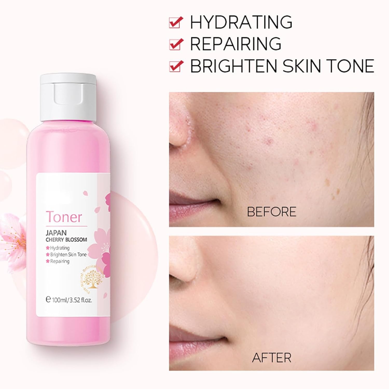 Sakura Face Care Set for Women, 17Pcs Moisturizing Skin Care Set Include Sakura Cream, Cleanser, Serum, Toner, Eye Cream, Lip Mask, Mud Mask, Sleeping Mask, Skin Care Routine for Daily Beauty Care