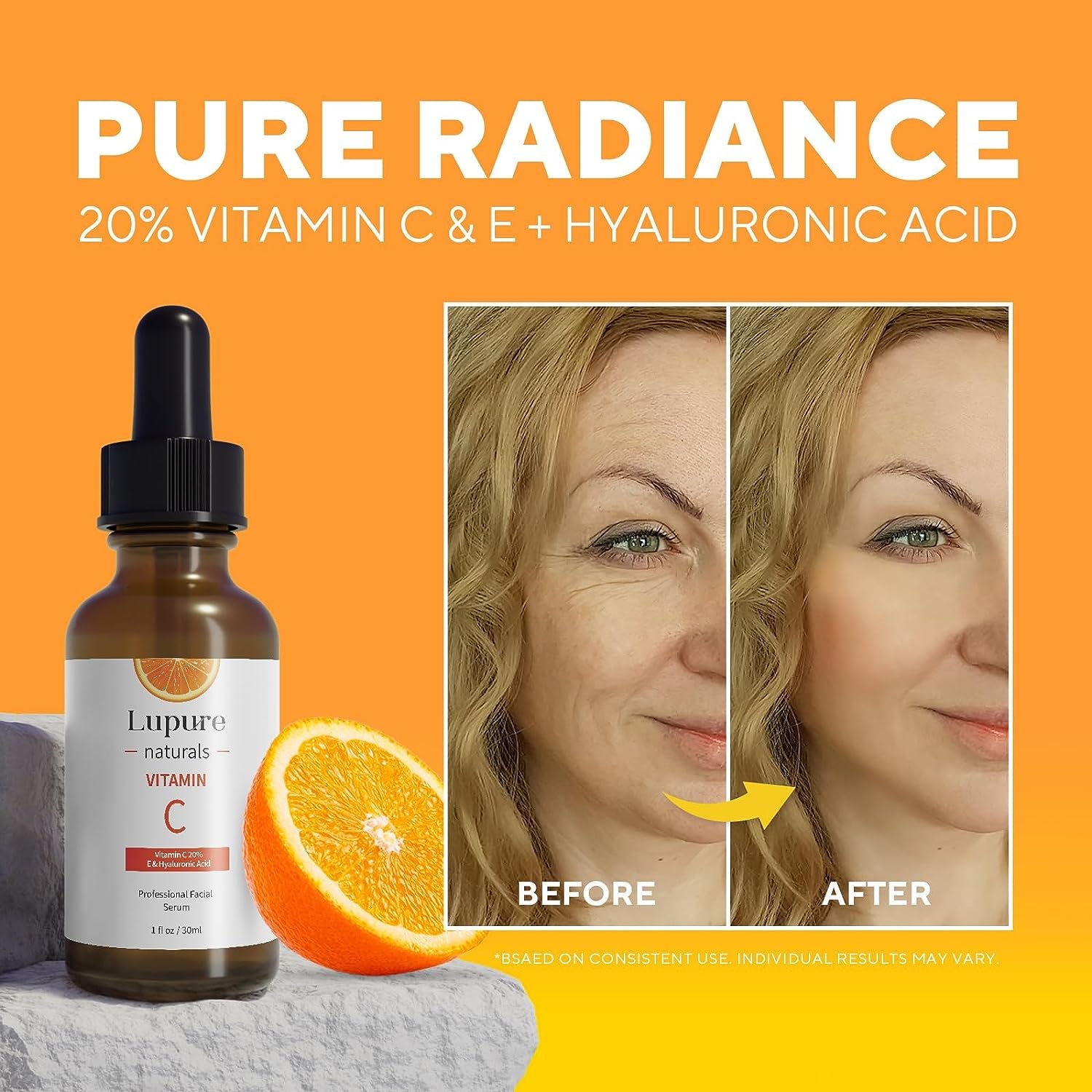 Professional Vitamin C Face Serum 20%, anti Aging Facial Super Vit C Serum with Hyaluronic Acid & Vitamin E for Dark Spots, Skin Care, Christmas Gift & Stocking Stuffers | 1 Fl. Oz