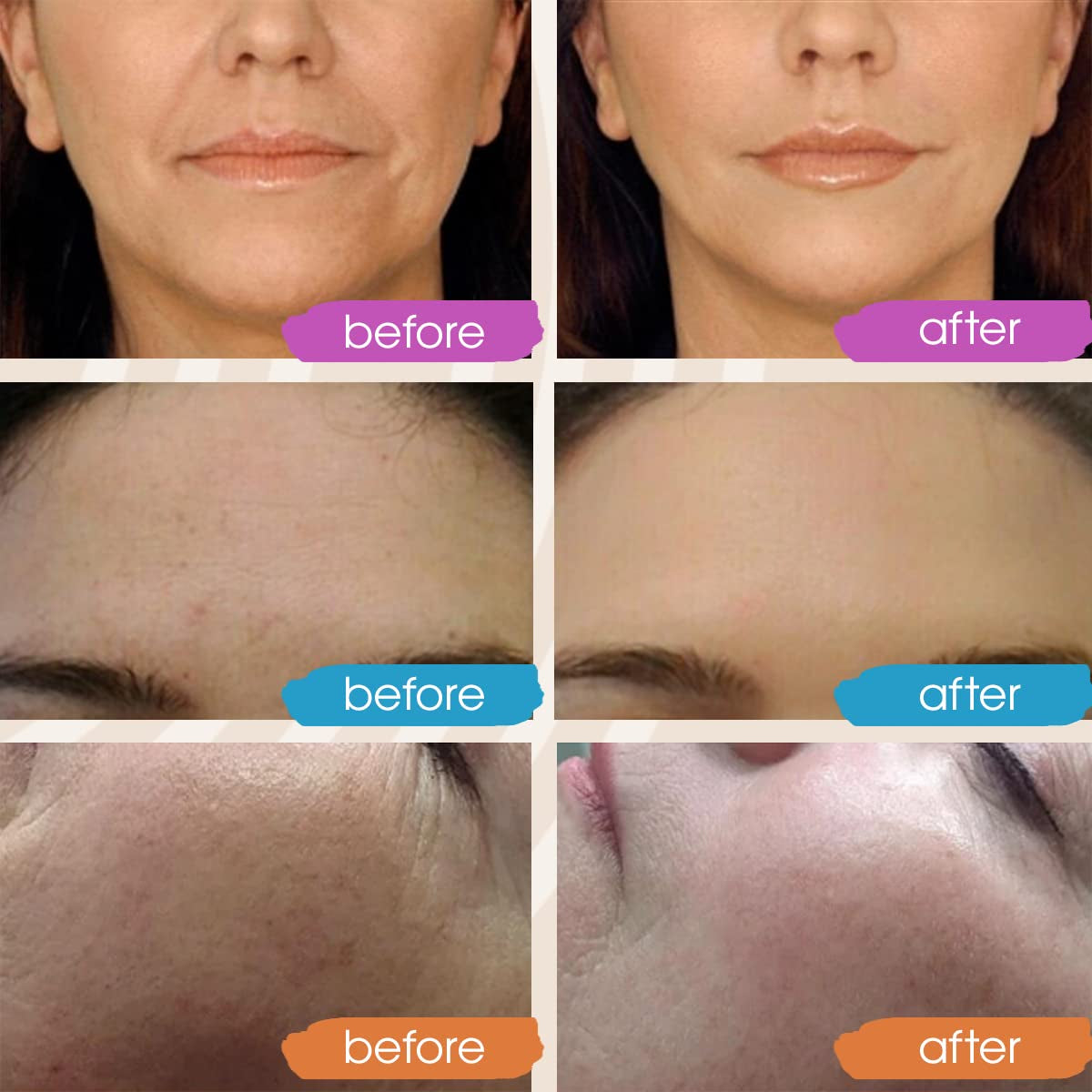 Retinol Serum for Face - Vitamin C Face Serum with Hyaluronic Acid Serum for Face, Vitamin C Serum for Face, Retinol for Face anti Aging Serum, Glow Face Serum 3X2Oz