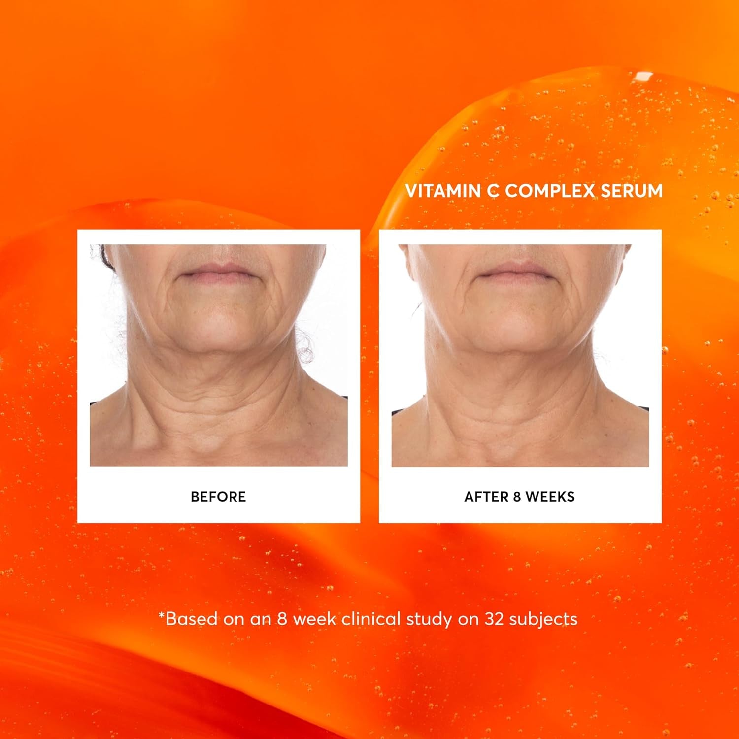 Vitamin C Complex Face Serum, Anti-Aging Facial Treatment with Hyaluronic Acid & Vitamin E, 1 Oz