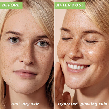 Hyaluronic Acid Moisturizer for Face - USA Made with Organic & Natural Ingredients - Sensitive Skin Moisturizer for Face, anti Aging Wrinkle Face Cream Women, Mens Natural Face Moisturizers