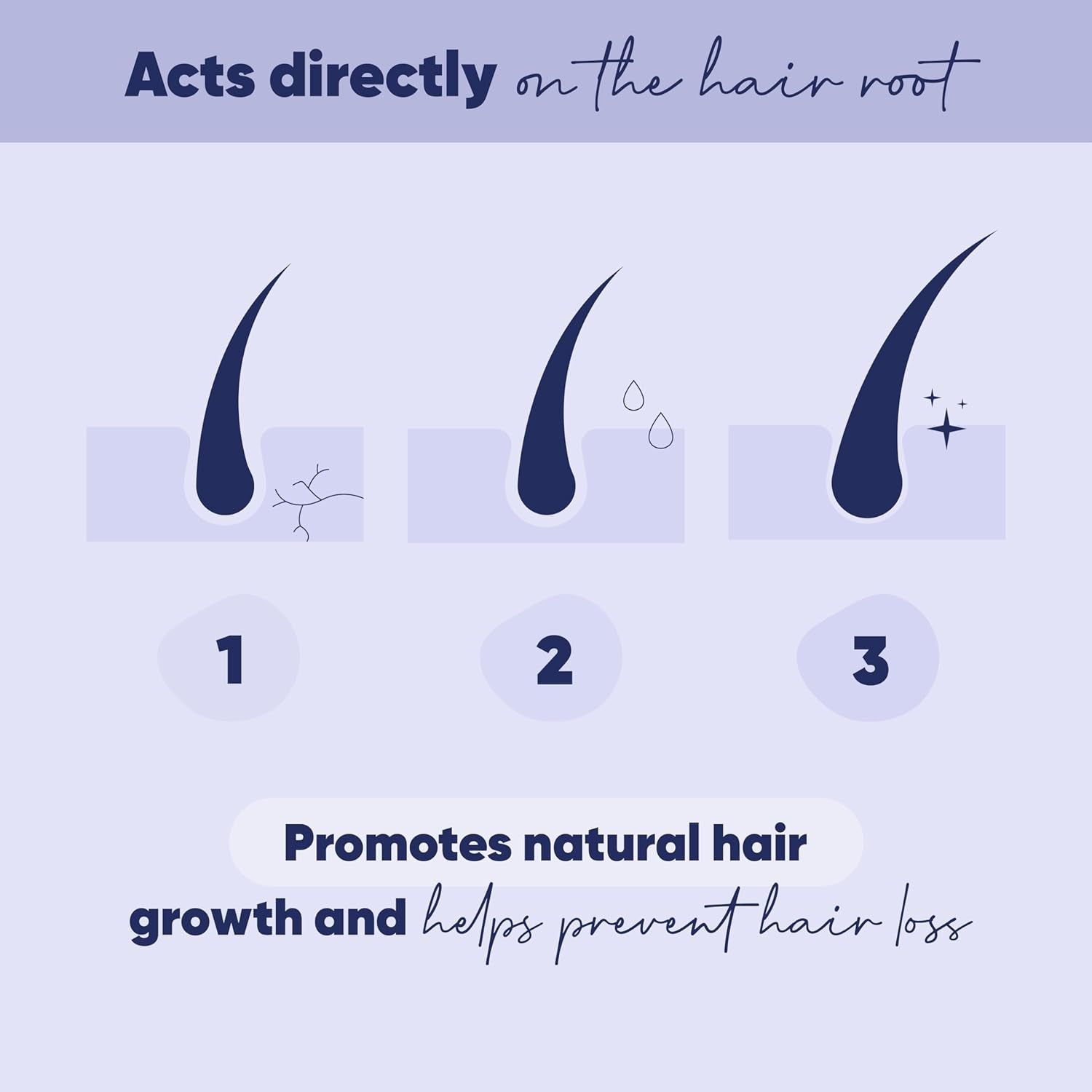MOERIE Ultimate Hair Growth Serum for Natural Hair Regrowth & Thickening - anti Thinning & Hair Loss Treatment for Women - Rapid Hair Growth Products - Scalp Oil Alternative - 1.69 Fl Oz / 50 Ml