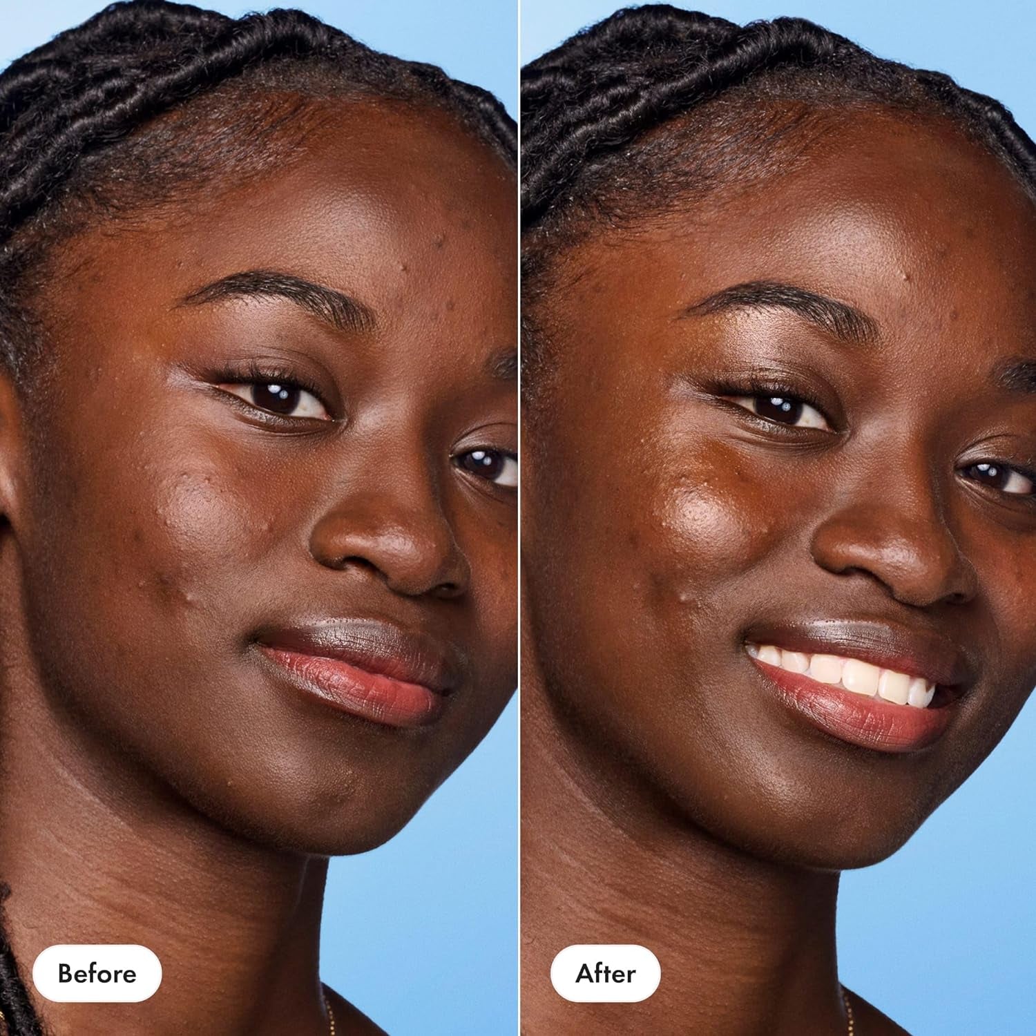 Glow Balm Radiant Skin Stick – Instantly Gives Skin a Glowy Finish for Dewy and Radiant Looking Skin – Suitable for Acne-Prone Skin – Won’T Clog Pores (0.4 Oz)