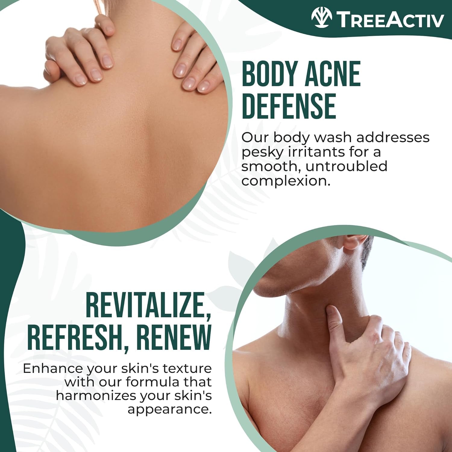 Exfoliating Acne Body Wash 8 Fl Oz Body Acne Wash for Back, Chest, Shoulder, Back Acne Treatment with Jojoba Beads, Back Acne Body Wash for Bacne, Soothing Body Acne Treatment for Men, Women