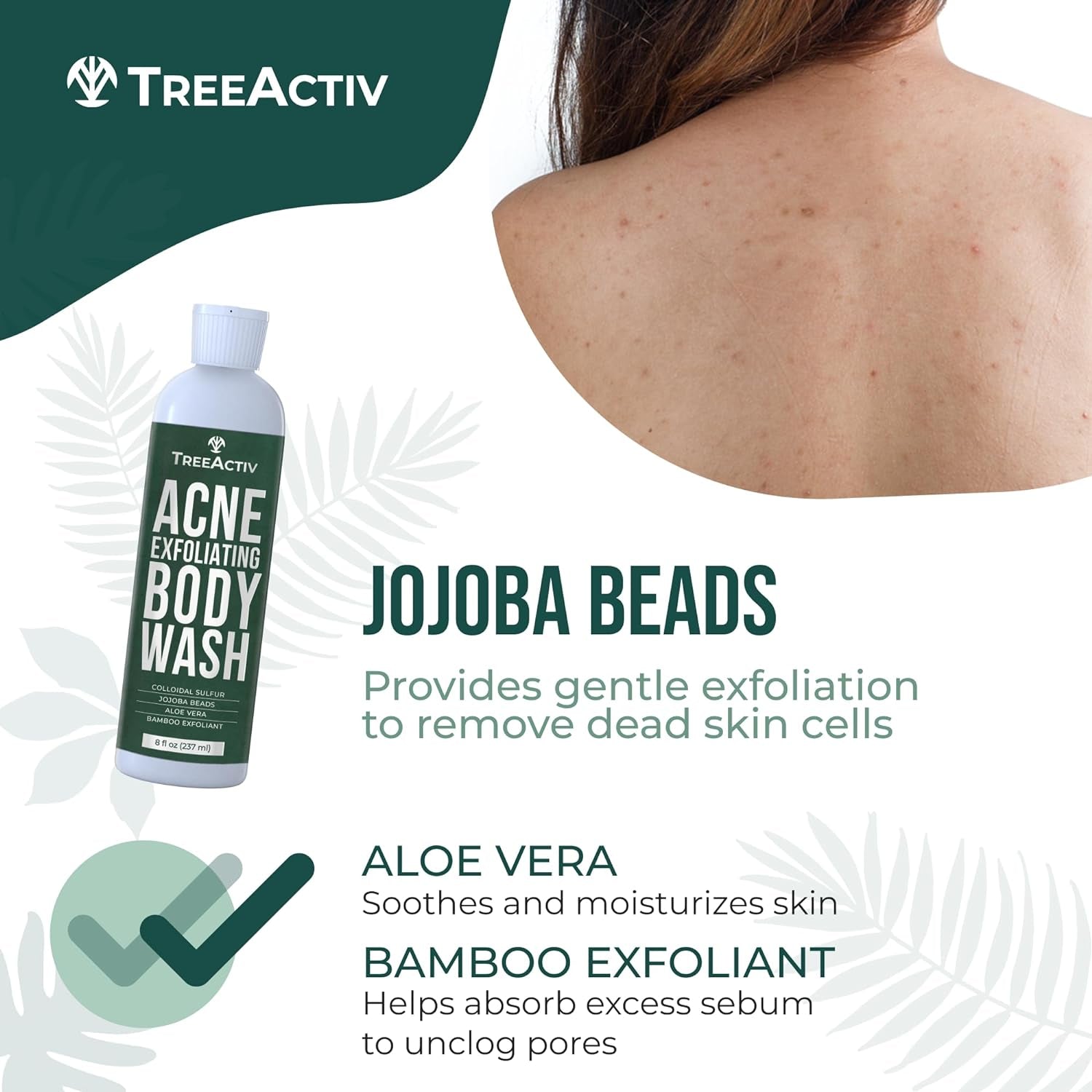 Exfoliating Acne Body Wash 8 Fl Oz Body Acne Wash for Back, Chest, Shoulder, Back Acne Treatment with Jojoba Beads, Back Acne Body Wash for Bacne, Soothing Body Acne Treatment for Men, Women