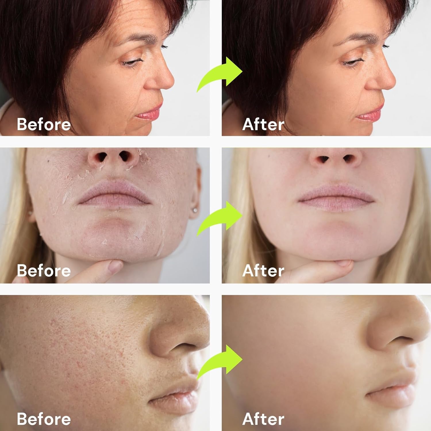 Anti Aging Retinol Facial Serum:  Serum for Face - Wrinkles Reducer Treatment with Retinol & Collagen & Hyaluronic Acid & Nicotinamide, Brightening & Firming Skincare Lotion