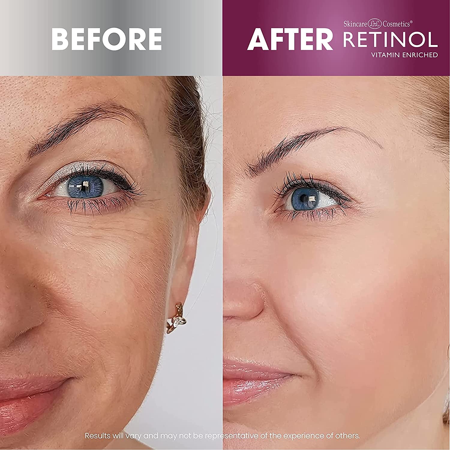 Anti-Aging Starter Kit – the Original  for a Younger Look – [4] Conveniently Sized Products Perfect for Travel or First Time Try – Cleanse, Treat, Repair & Hydrate On-The-Go