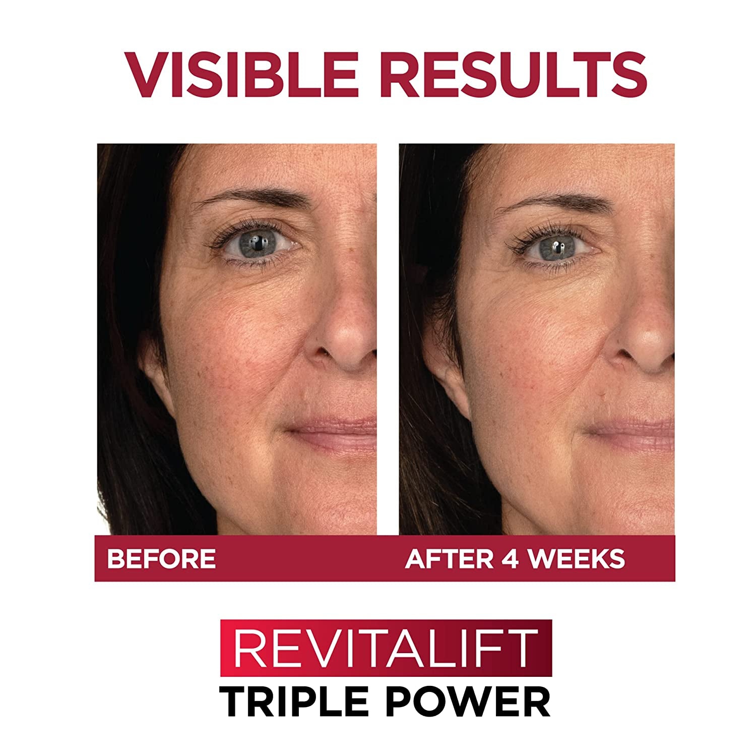 Revitalift Triple Power Anti-Aging Face Moisturizer, Pro Retinol, Hyaluronic Acid & Vitamin C, Reduce Wrinkles 2.55 Oz